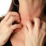 Mujer rascando su cuello