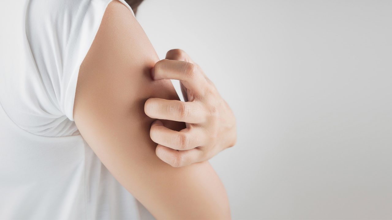 Consejos para tratar la dermatitis en la piel